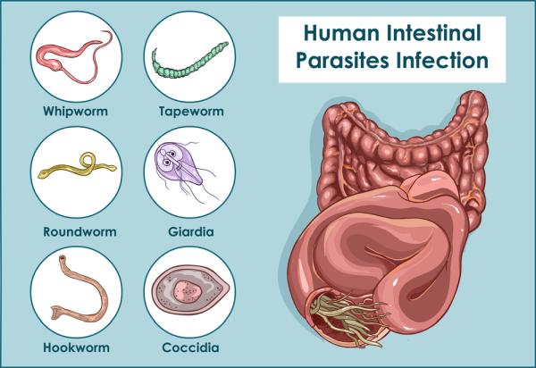 parazity