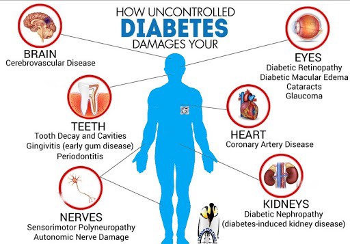 In che modo il diabete influisce sul tuo corpo?